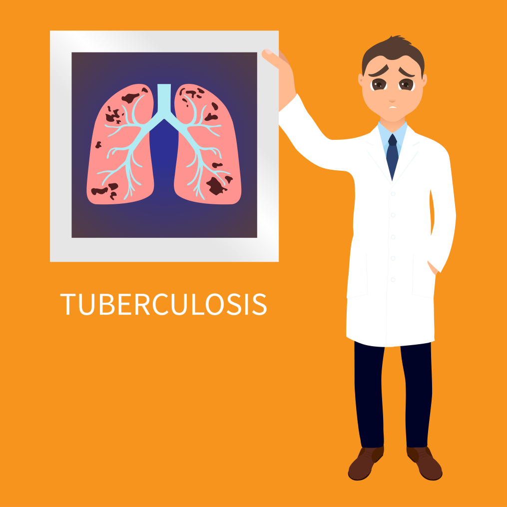 Complete Guide to Tuberculosis Causes, Symptoms &#038; Treatment