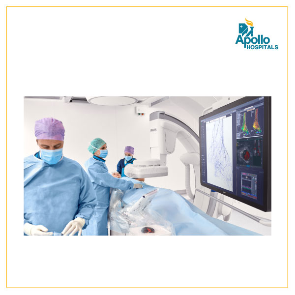 IVUS Angioplasty