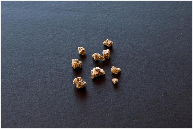Natural remedies for kidney stones