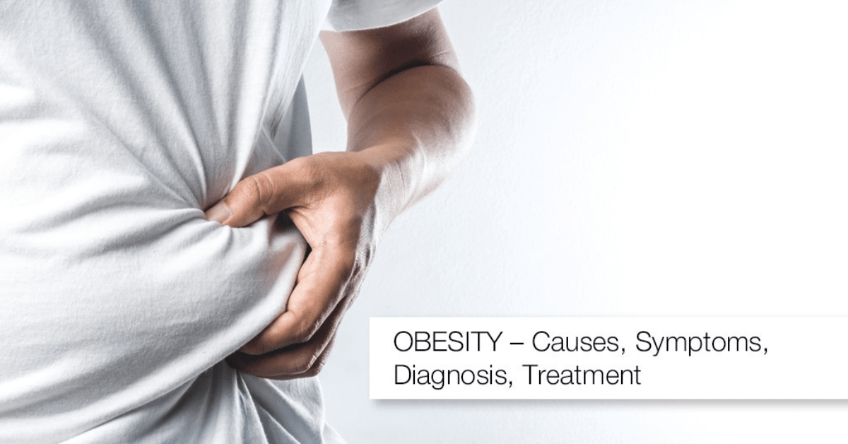 OBESITY – Causes, Symptoms, Diagnosis, Treatment OBESITY – Causes, Symptoms, Diagnosis, Treatment