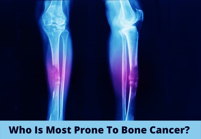 Who Is Most Prone To Bone Cancer? Who Is Most Prone To Bone Cancer?