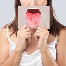 Busting Myths &#038; Facts about Oral Cancer